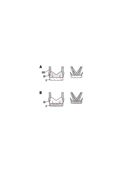 Brassière n°107 de Burda Style Janvier 2017
