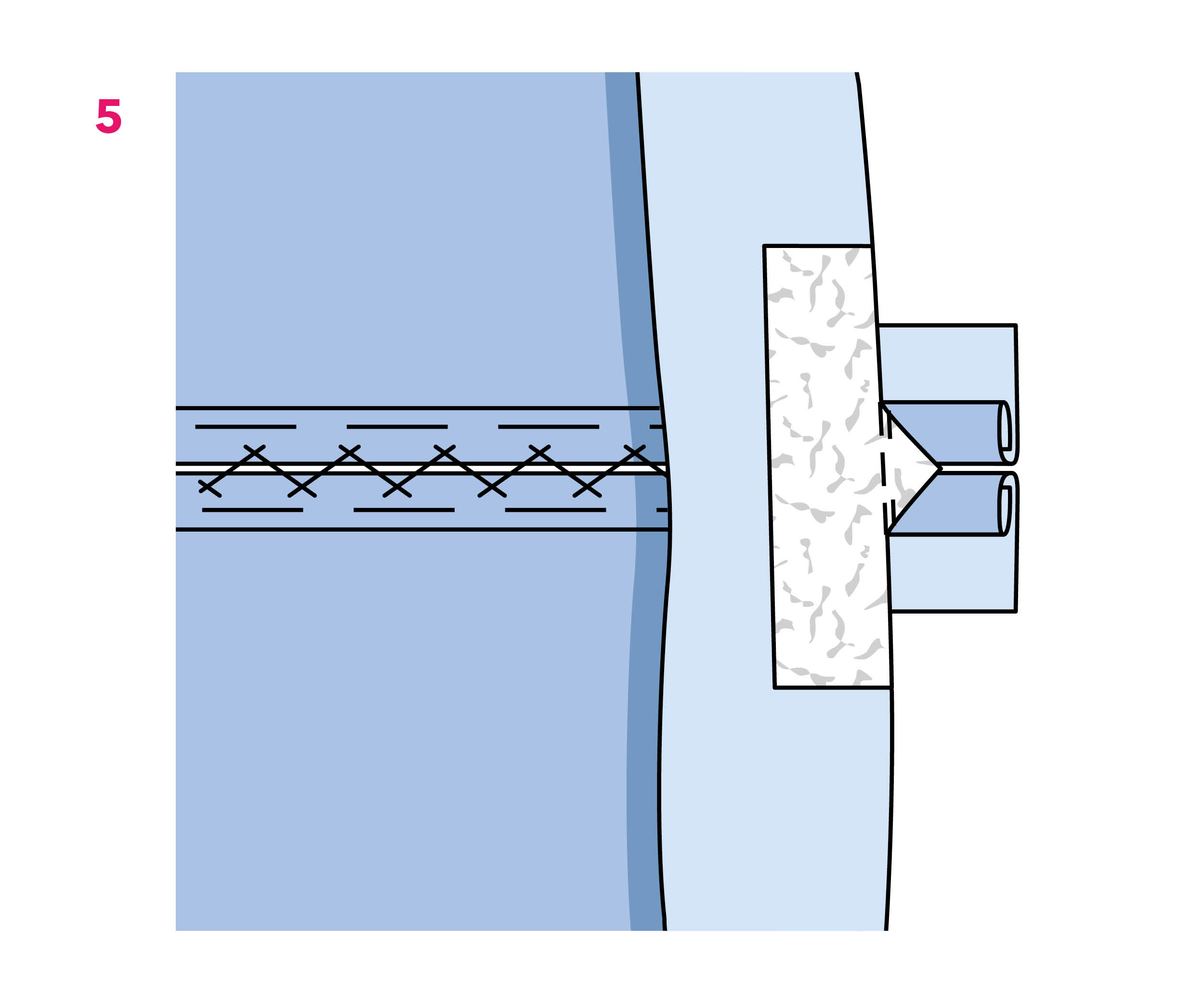 Comment coudre une poche passepoilée ? Comment coudre une poche passepoilée ?